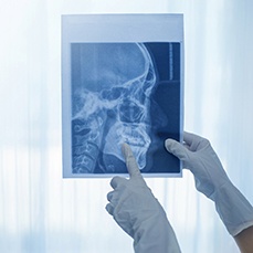 a dentist pointing to an X-ray of a face