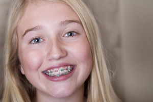 Young girl with braces